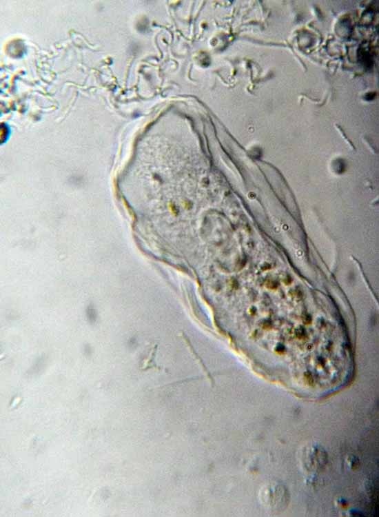 Thecamoeba del muschio